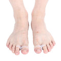2Pcs Slimming Silicone Foot Massage Magnetic Toe Ring Magnetic Slimming Toe Rings 