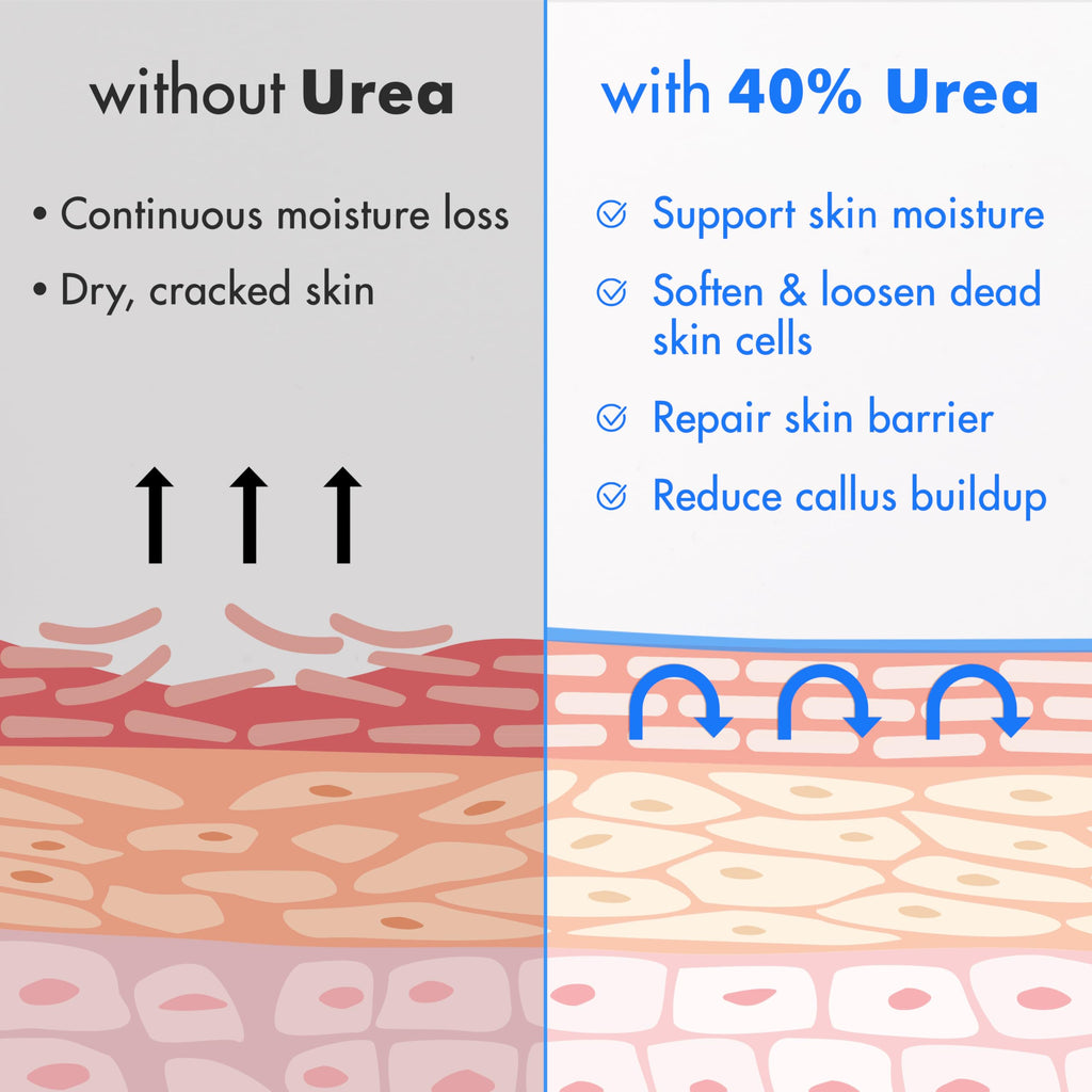 Ebanel Urea Cream 40% plus Salicylic Acid 2%, Foot Cream for Dry Cracked Heels Feet Knees Elbows Hands, Foot Dead Skin Cuticle Callus Remover Toenail Softener, Keratolytic Skin Barrier Repair Ebanel buy supplements Au