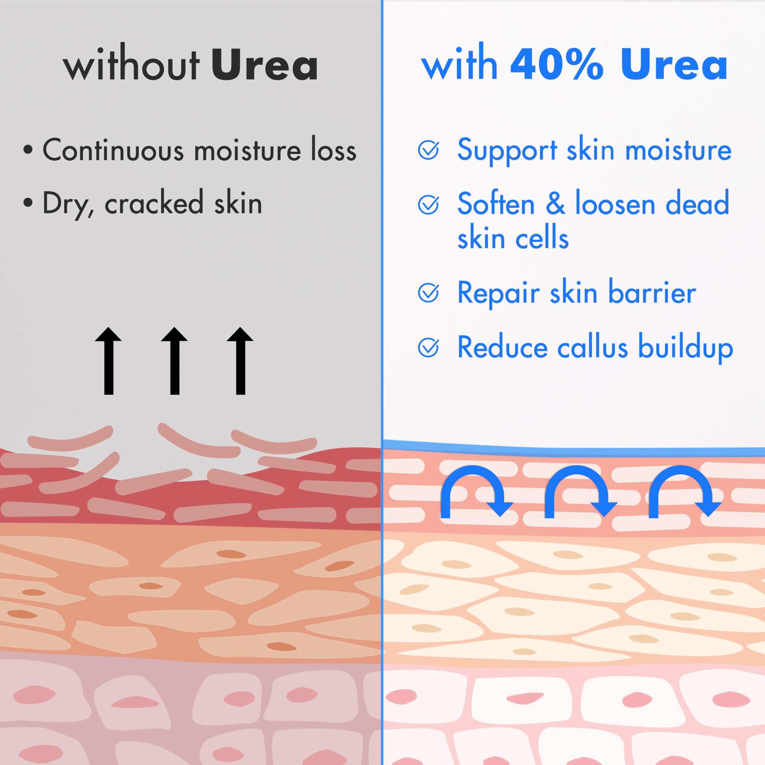 Ebanel Urea Cream 40% plus Salicylic Acid 2%, Foot Cream for Dry Cracked Heels Feet Knees Elbows Hands, Foot Dead Skin Cuticle Callus Remover Toenail Softener, Keratolytic Skin Barrier Repair, 2-Pack Ebanel buy supplements Au