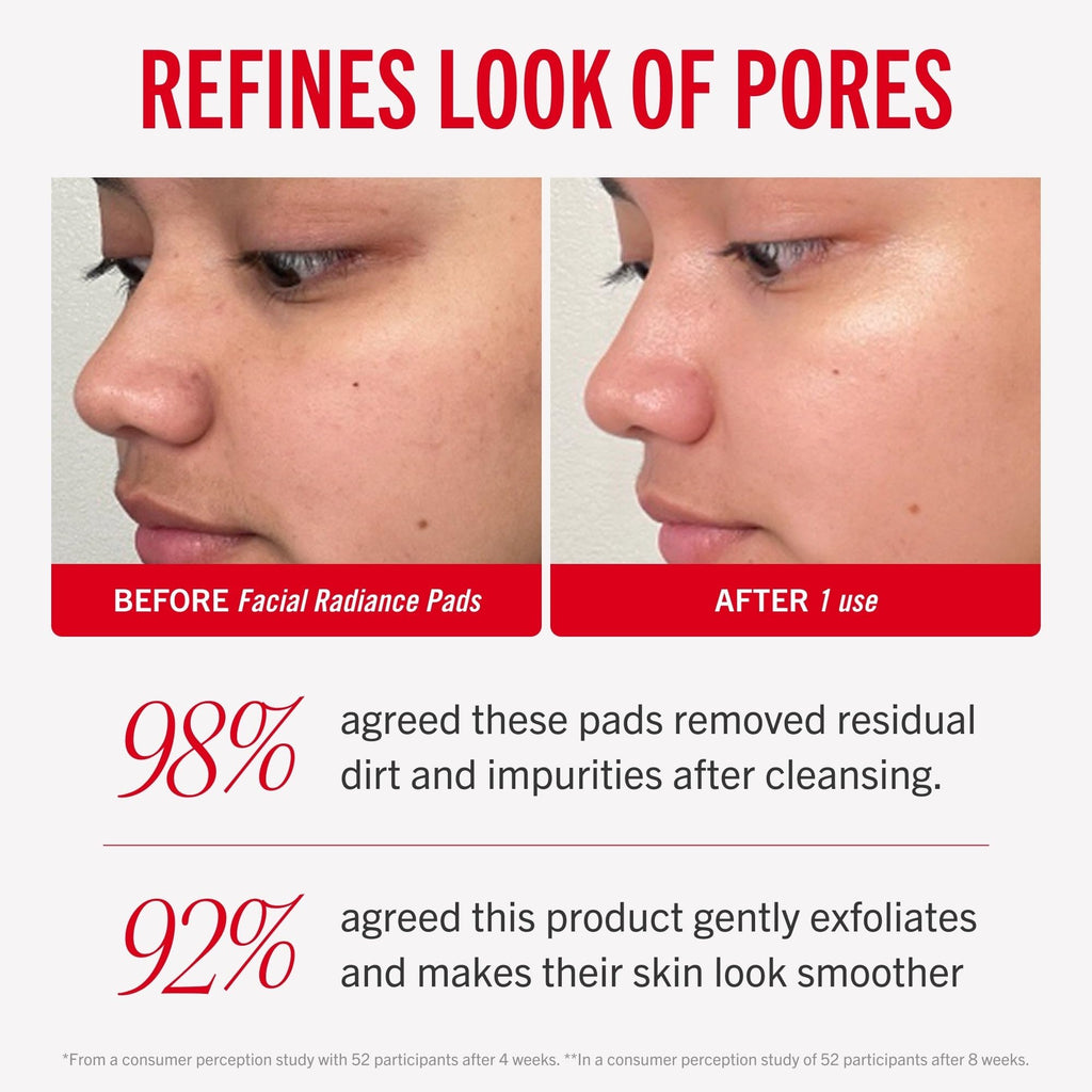 First Aid Beauty - Facial Radiance Pads with Glycolic & Lactic Acids, Daily Exfoliating Pads