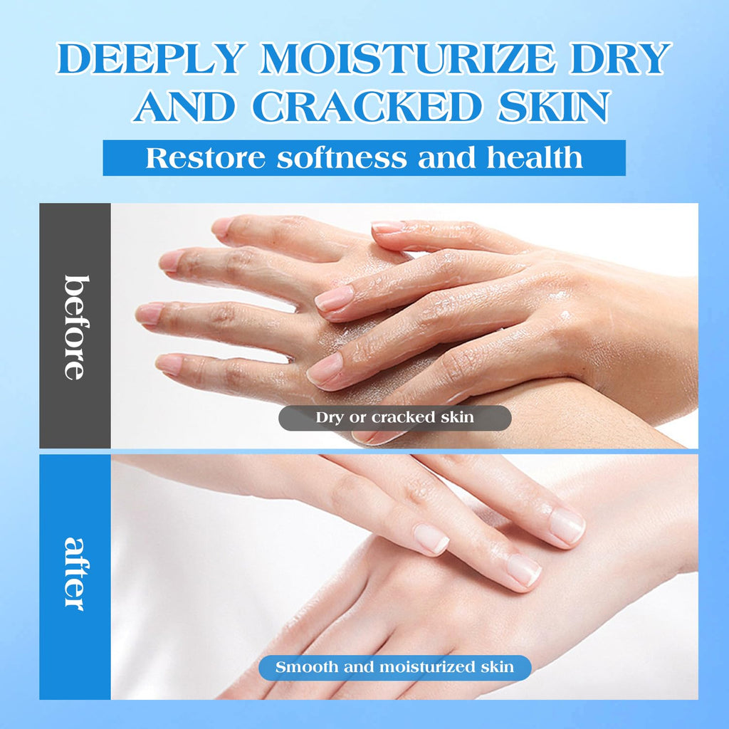 42% Urea Cream for Dry & Cracked Skin - Foot & Hand Cream with 2% Salicylic Acid, 5% Vitamin E, Tea Tree Oil, Aloe Vera, Shea Butter - Moisturizer & Skin Repair Cream for Feet Maximum Strength URQT buy supplements Au
