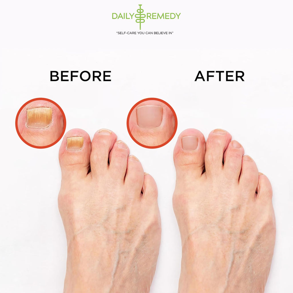 Muscle Relief Foot Soak with Epsom Salt, Made in USA, Soothe Foot Aches, Muscle Pain DAILY REMEDYBuy Supplements Australia