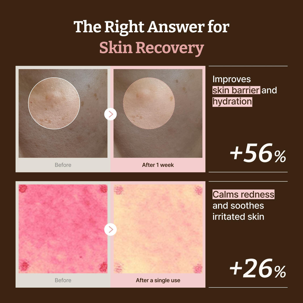 Dr.Reju-All Advanced PDRN Rejuvenating Cream Max – 99% Pure Salmon DNA Gel Type Face Moisturizer – Optimal 1200ppm for Glass Skin & Plumping – Korean Pharmacy Anti-Aging Skin Care Face Cream -2 Fl Oz Dr.Reju-All buy supplements Au