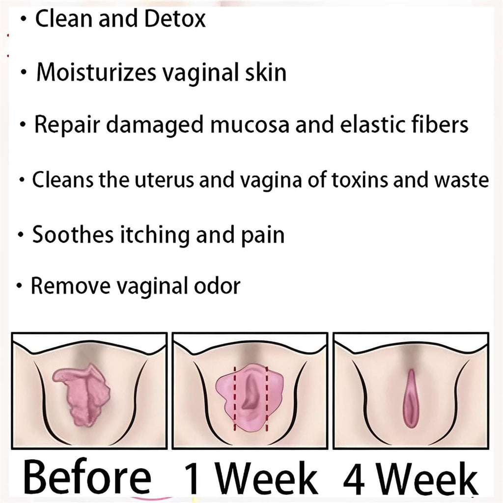 Dexcara Detox Repair, AnnieCare Natural Repair Vaginal Capsules, Anniecare Instant Anti YeeKeniOBuy Supplements Australia
