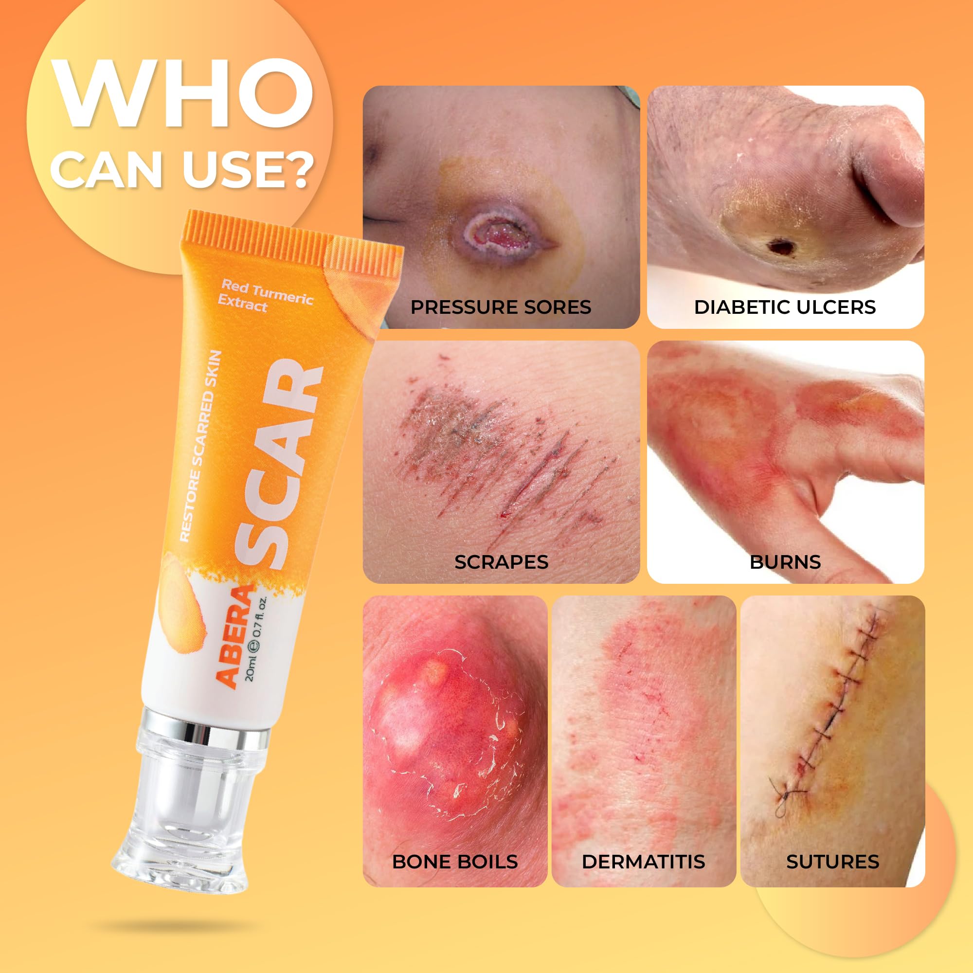ABERA Scar Removal Cream for Women and Men - Rapid Repair of New Old Scars, Spots, Burns All Natural Treatment with Vitamin E, Alanine, Collagen (1 Box + 3 Eye Patch) ABERABuy Supplements Australia