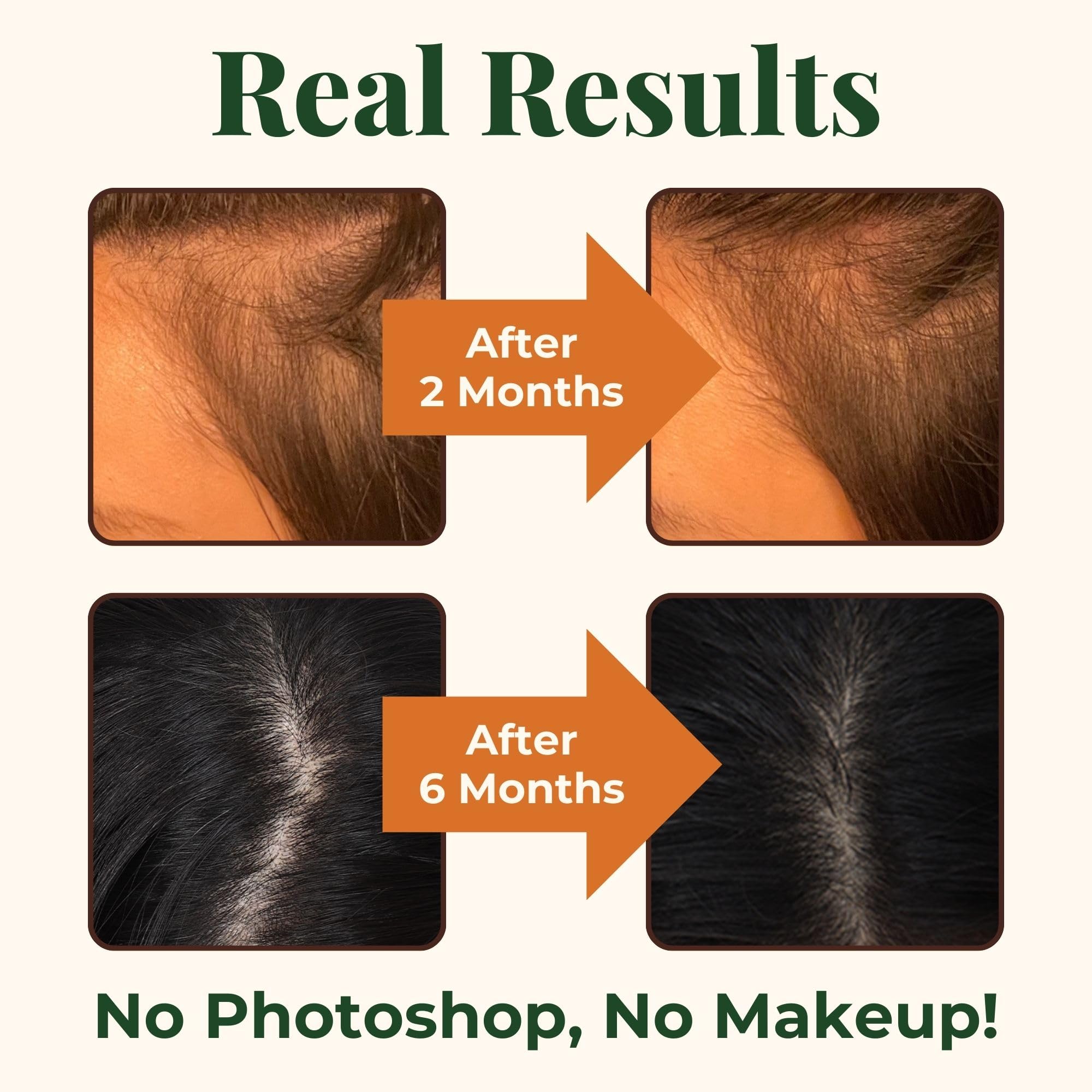 Heebin's Royal Hair, Brows & Lashes, Hair Growth Vitamins with Biotin 4000 mcg, Collagen Heebin'sBuy Supplements Australia