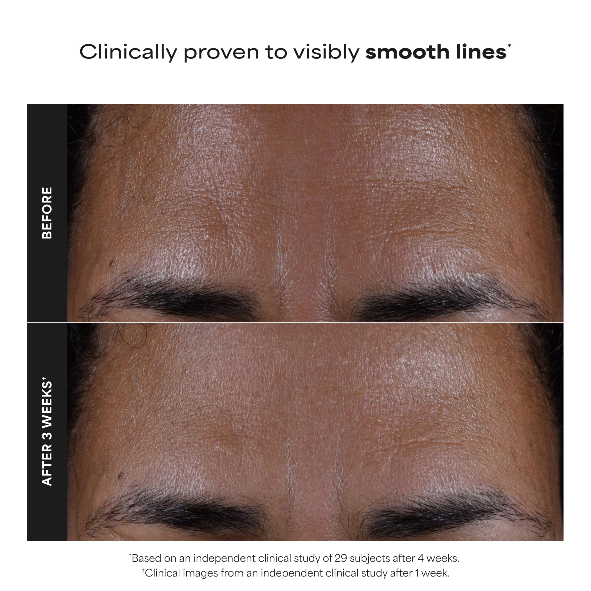 Paulas Choice--SKIN PERFECTING 2% BHA Liquid Salicylic Acid Exfoliant--Facial Exfoliant